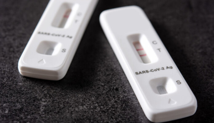 Ātrie COVID-19 testi. Foto: freepik.com Ātrie COVID-19 testi. Foto: freepik.com